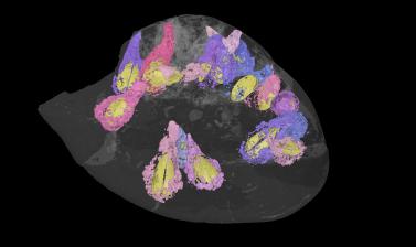 Three-dimensional computer reconstruction of a fossil sea urchin, riddled with borings made by bivalves