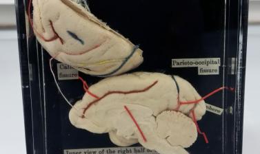 Liontailed Macaque Brain Before Treatment