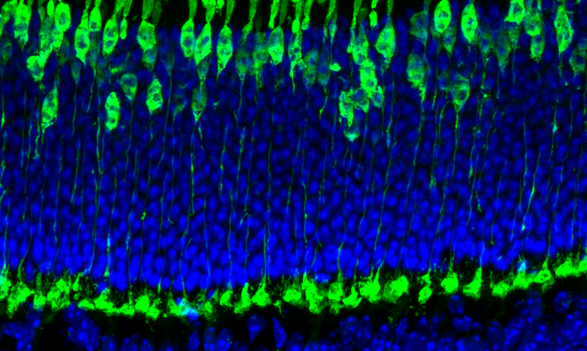 Cones with retina layers shown